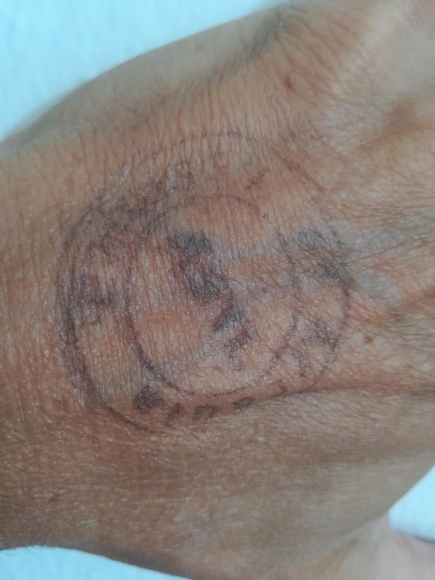 Asylstempel